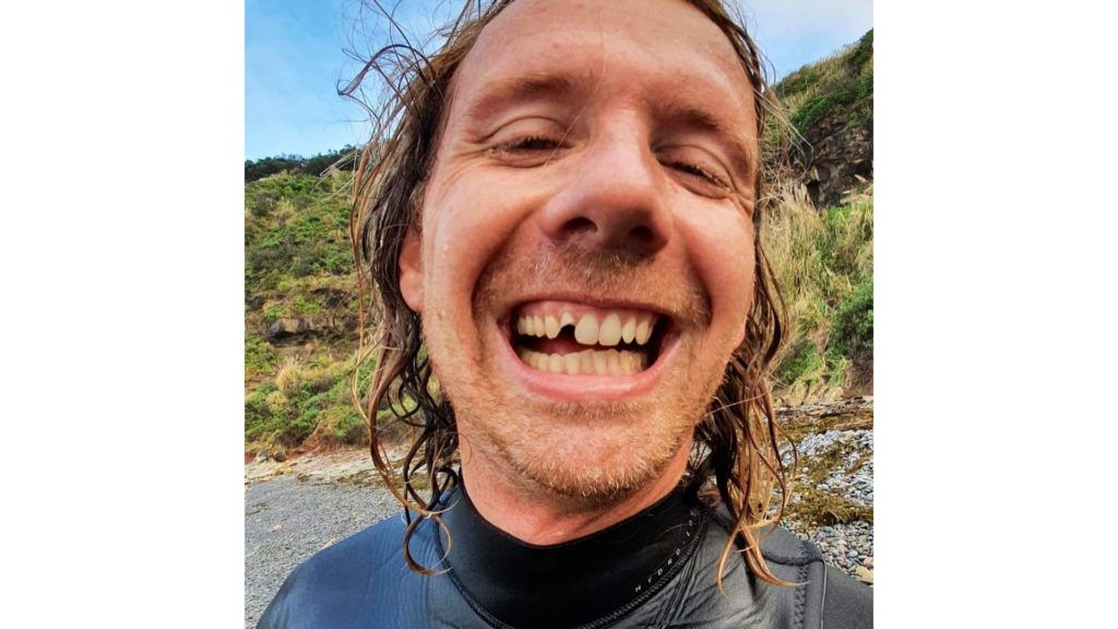 Surf cinematographer Adrian Emerton during his shoot for The Chase. A work accident. Picture: Adrian Emerton Instagram